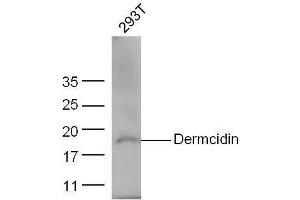 293T cell lysates probed with Anti-Dermcidin/DCD Polyclonal Antibody, Unconjugated  at 1:5000 for 90 min at 37˚C. (Dermcidin antibody  (AA 63-109))
