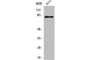 Western Blot analysis of HeLa cells using Phospho-Rad17 (S645) Polyclonal Antibody (RAD17 antibody  (pSer645))