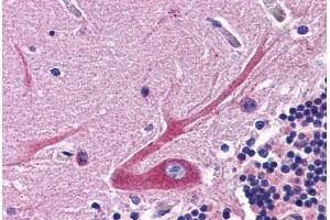 Human Brain, Cerebellum: Formalin-Fixed, Paraffin-Embedded (FFPE) (NDUFB9 antibody  (C-Term))
