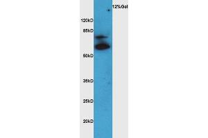 Lane 1: rat brain lysates probed with Rabbit Anti-VAT Polyclonal Antibody, Unconjugated (ABIN735113) at 1:300 overnight at 4 °C. (SLC18A3 antibody  (AA 201-300))