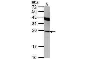 WB Image Sample (30 ug of whole cell lysate) A: A431 , 12% SDS PAGE antibody diluted at 1:1000 (IFNA2 antibody  (C-Term))