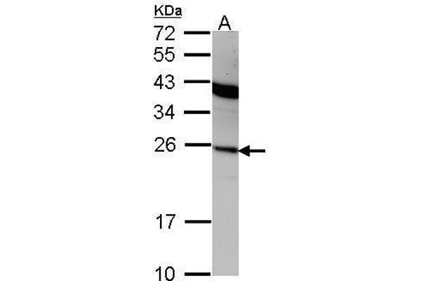 IFNA2 Antikörper  (C-Term)