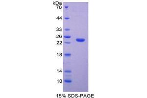 SDS-PAGE (SDS) image for TIMP Metallopeptidase Inhibitor 4 (TIMP4) (AA 50-224) protein (His tag) (ABIN1878761) (TIMP4 Protein (AA 50-224) (His tag))