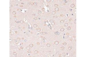 Immunohistochemistry of paraffin-embedded Mouse brain using ABCF2 Polyclonal Antibody at dilution of 1:100 (40x lens). (ABCF2 antibody)