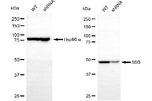 Western blotting analysis using SSB antibody (ABIN7800357).