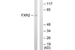 Western blot analysis of extracts from COLO205 cells, using FXR2 antibody. (FXR2 antibody)