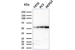 Western Blot Analysis of T47D, PC3, HePG2 cell lysates using GPI Mouse Monoclonal Antibody (CPTC-GPI-1). (GPI antibody)