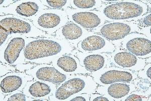 IHC analysis of PDCD6IP using anti-PDCD6IP antibody (ABIN7600490).
