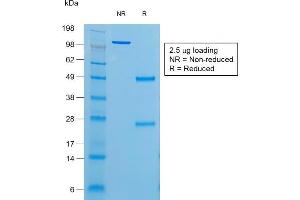 SDS-PAGE Analysis of Purified Thyroglobulin Mouse Recombinant Monoclonal Antibody (r6E1). (Recombinant Thyroglobulin antibody)