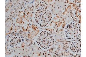ABIN6268991 at 1/200 staining human kidney tissue sections by IHC-P. (PPP1R12A antibody  (pThr853))