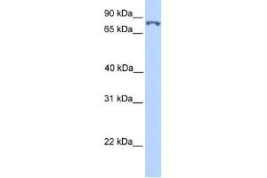 WB Suggested Anti-SSRP1 Antibody Titration:  0. (SSRP1 antibody  (N-Term))