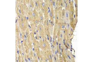 Immunohistochemistry of paraffin-embedded mouse heart using PLCG2 antibody (ABIN5971208) at dilution of 1/100 (40x lens).