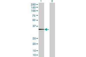 Western Blot analysis of TBC1D21 expression in transfected 293T cell line by TBC1D21 MaxPab polyclonal antibody. (TBC1D21 antibody  (AA 1-336))