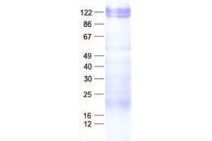 Validation with Western Blot (ZNF274 Protein (His tag))
