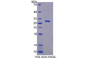 Image no. 1 for Replication Factor C (Activator 1) 4, 37kDa (RFC4) (AA 1-213) protein (His tag) (ABIN5665367)