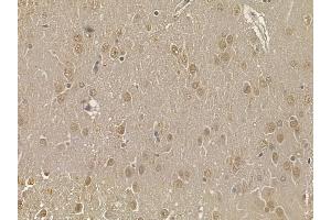 PPP1CA Mouse Monoclonal Antibody at 1/100 staining rat brain tissue by IHC-P.