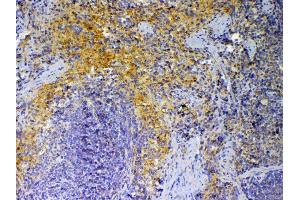 IHC analysis of PF4 using anti-PF4 antibody . (PF4 antibody  (AA 30-105))