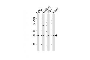 All lanes : Anti-HAVCR2 Antibody (Center) at 1:2000 dilution Lane 1: T47D whole cell lysates Lane 2: human kidney lysates Lane 3: KG-1 whole cell lysates Lane 4: human liver lysates Lysates/proteins at 20 μg per lane. (TIM3 antibody  (AA 167-194))