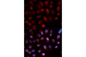 Immunofluorescence analysis of U2OS cells using ETV4 antibody.