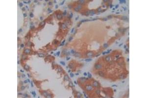IHC-P analysis of Human Tissue, with DAB staining. (Kazald1 antibody  (AA 31-304))