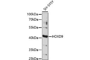 Western blot analysis of extracts of SH-SY5Y cells, using HOXD9 antibody (ABIN7267776) at 1:1000 dilution. (HOXD9 antibody  (AA 100-200))