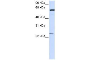 TMEM138 antibody used at 1 ug/ml to detect target protein. (TMEM138 antibody  (N-Term))