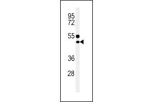 CD1e anticorps  (AA 184-212)
