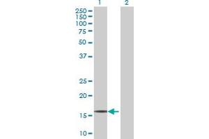 Western Blot analysis of RPP21 expression in transfected 293T cell line by RPP21 MaxPab polyclonal antibody. (RPP21 antibody  (AA 1-154))
