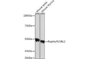 Western blot analysis of extracts of various cell lines, using Reptin/RUVBL2 Rabbit mAb (ABIN7270119) at 1:1000 dilution. (RUVBL2 antibody)