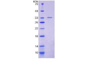 SDS-PAGE analysis of Mouse POLa1 Protein. (POLA1 Protein)