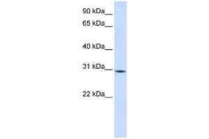 WB Suggested Anti-RBM7 Antibody Titration:  0. (RBM7 antibody  (Middle Region))