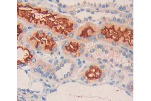 Figure. (EPH Receptor A10 antibody  (AA 645-900))