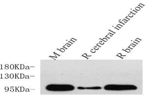 Western Blot analysis of various samples using DLG4 Polyclonal Antibody at dilution of 1:750. (DLG4 antibody)