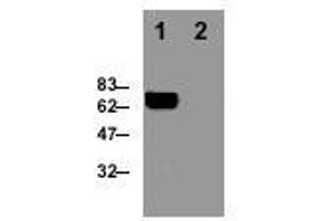 Image no. 1 for anti-Perforin 1 (Pore Forming Protein) (PRF1) antibody (ABIN187561) (Perforin 1 antibody)