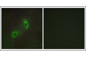 Immunofluorescence (IF) image for anti-Hepatocyte Growth Factor-Regulated tyrosine Kinase Substrate (HGS) (Internal Region) antibody (ABIN784218)