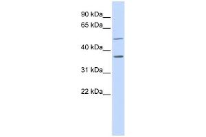 ZADH1 antibody used at 1 ug/ml to detect target protein. (PTGR2 antibody  (Middle Region))