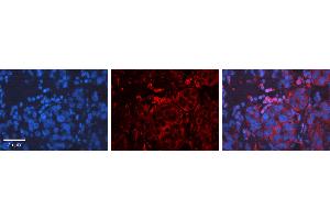 Rabbit Anti-CCND1 Antibody Catalog Number: ARP30163_P050 Formalin Fixed Paraffin Embedded Tissue: Human Liver Tissue Observed Staining: Cytoplasm, Plasma membrane Primary Antibody Concentration: 1:600 Other Working Concentrations: N/A Secondary Antibody: Donkey anti-Rabbit-Cy3 Secondary Antibody Concentration: 1:200 Magnification: 20X Exposure Time: 0. (Cyclin D1 antibody  (Middle Region))