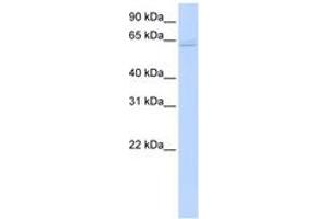 Image no. 1 for anti-TNF Receptor-Associated Factor 6 (TRAF6) (C-Term) antibody (ABIN6742184) (TRAF6 antibody  (C-Term))