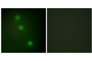 Immunofluorescence analysis of HUVEC cells, using ATF1 antibody. (AFT1 antibody  (C-Term))