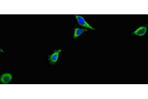 Immunofluorescent analysis of Hela cells using ABIN7143102 at dilution of 1:100 and Alexa Fluor 488-congugated AffiniPure Goat Anti-Rabbit IgG(H+L) (ACTR3 antibody  (AA 352-409))