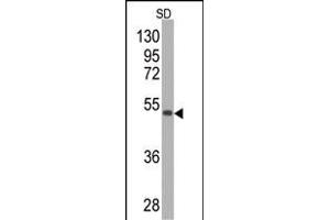 Western blot analysis of anti-SOD2 Monoclonal Antibody (ABIN387807 and ABIN2843901) by SOD2-GST fusion protein (GST MW=26 kD. (SOD2 antibody)