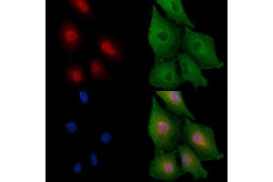 ABIN6258408 and ABIN6275691 staining  cells by IF/ICC.