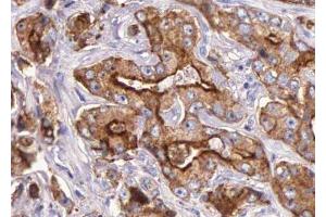 ABIN6276035 at 1/100 staining human Prostate tissue sections by IHC-P. (GPR35 antibody  (Internal Region))