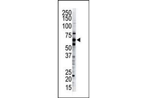 Western Blotting (WB) image for anti-Ubiquilin 2 (UBQLN2) (C-Term) antibody (ABIN357610) (Ubiquilin 2 antibody  (C-Term))