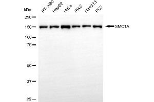 Western blotting analysis using SMC1A antibody (ABIN7800446).