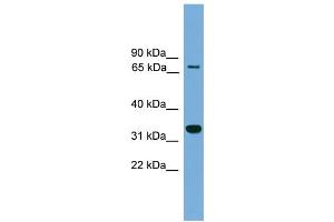 WB Suggested Anti-BCAN Antibody Titration: 0.