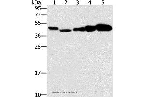 Western blot analysis of Hela, Raji, Jurkat, A549 and NIH/3T3 cell, using PPAT Polyclonal Antibody at dilution of 1:250 (PPAT antibody)