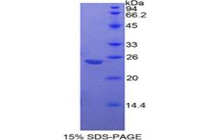 SDS-PAGE analysis of Mouse Insulin Like Growth Factor Binding Protein 7 (IGFBP7) Protein.