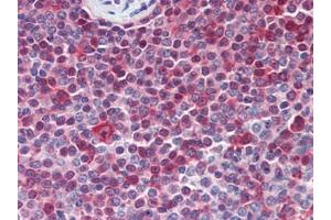 Human Spleen (formalin-fixed, paraffin-embedded) stained with PARP1followed by biotinylated goat anti-rabbit IgG secondary antibody, alkaline phosphatase-streptavidin and chromogen. (PARP1 antibody  (N-Term))