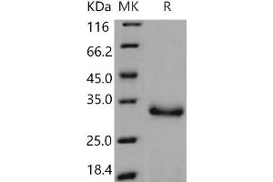 PRSS2 Protein (His tag)